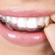 Illustration for article titled The Cost of Dental Crown in Austin, TX - How Much Will You Pay?em/em